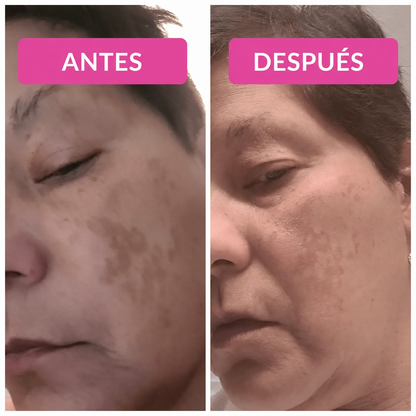 Vibriance Super C™ — Sérum Facial Intensivo para Piel Madura