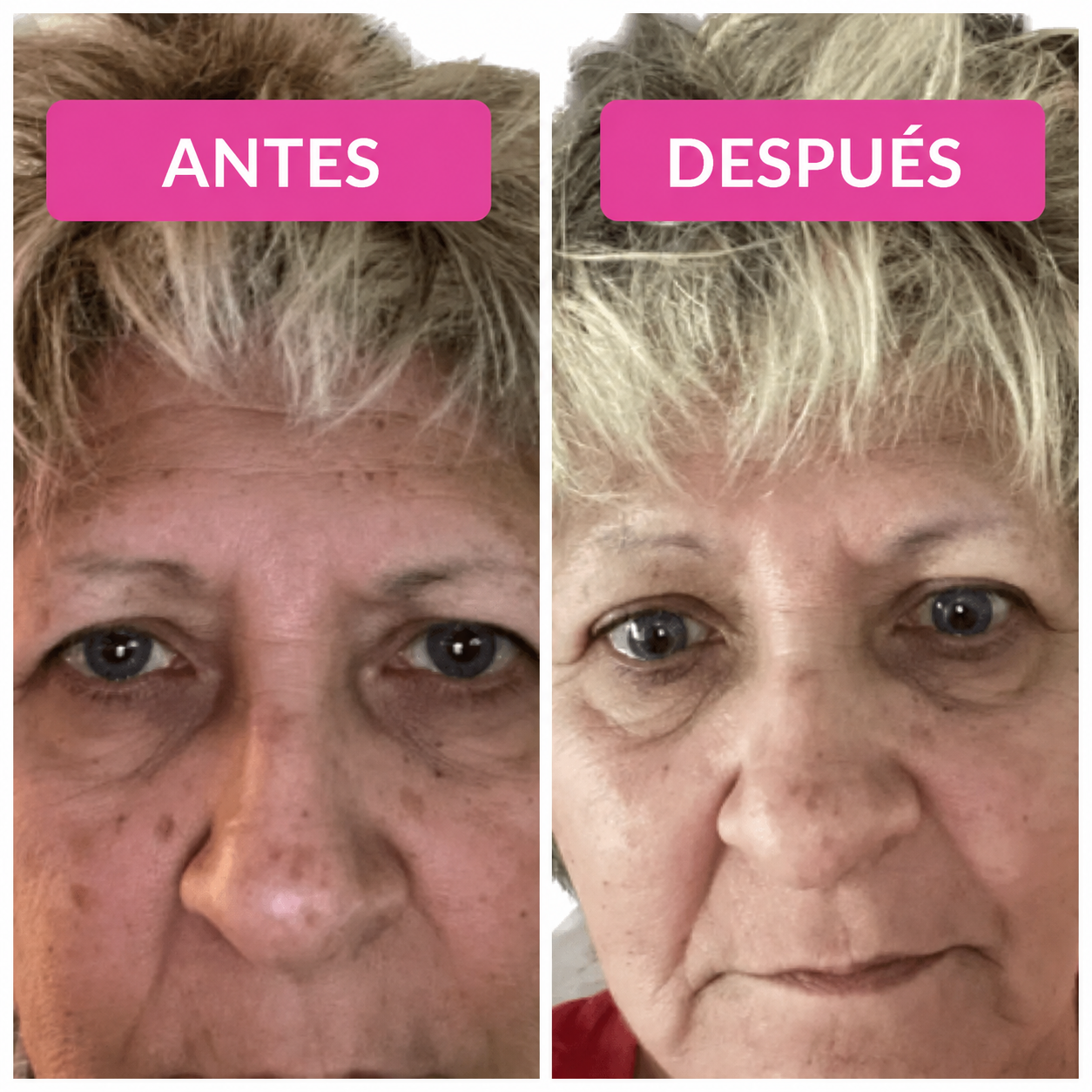 Vibriance Super C™ — Sérum Facial Intensivo para Piel Madura
